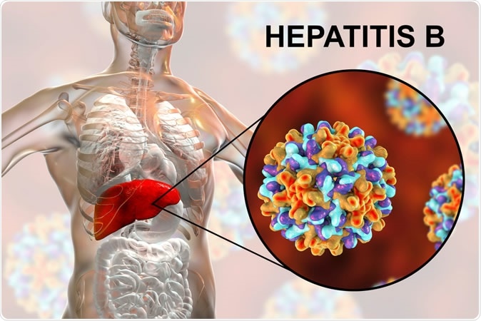 Hepatitis B in Deutschland